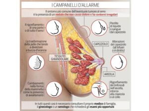 Sintomi carcinoma mammella-campanelli allarme